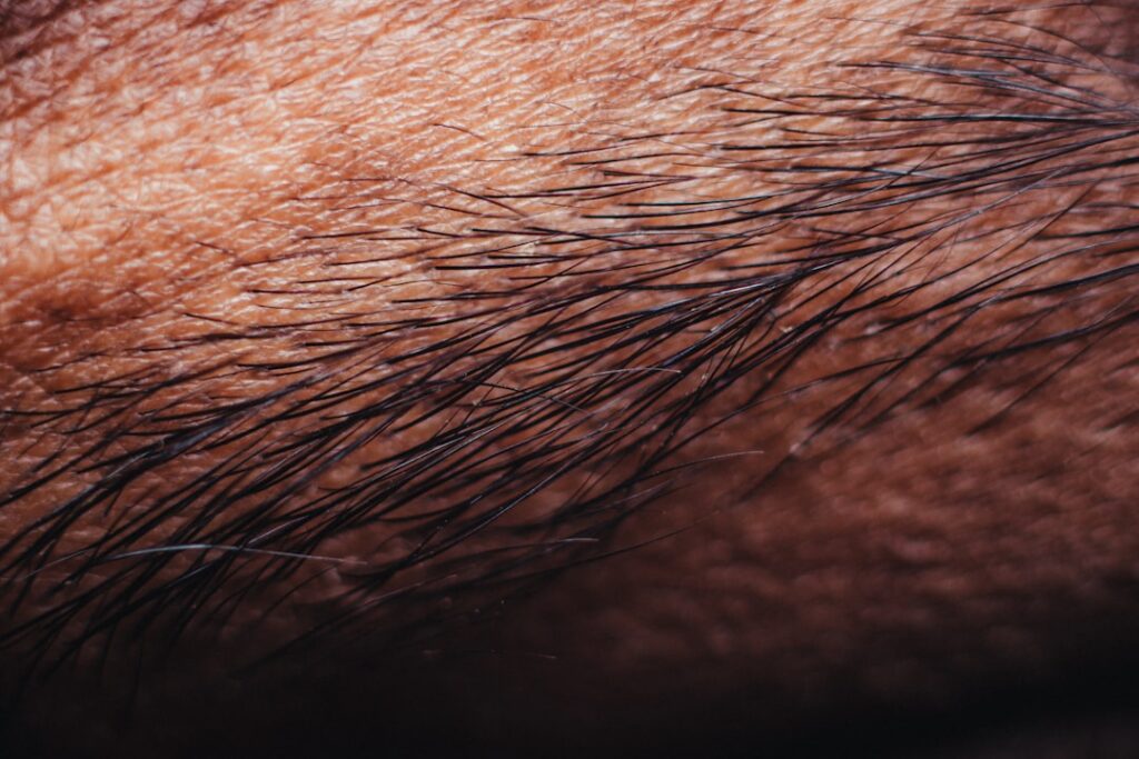Microblading for hair loss