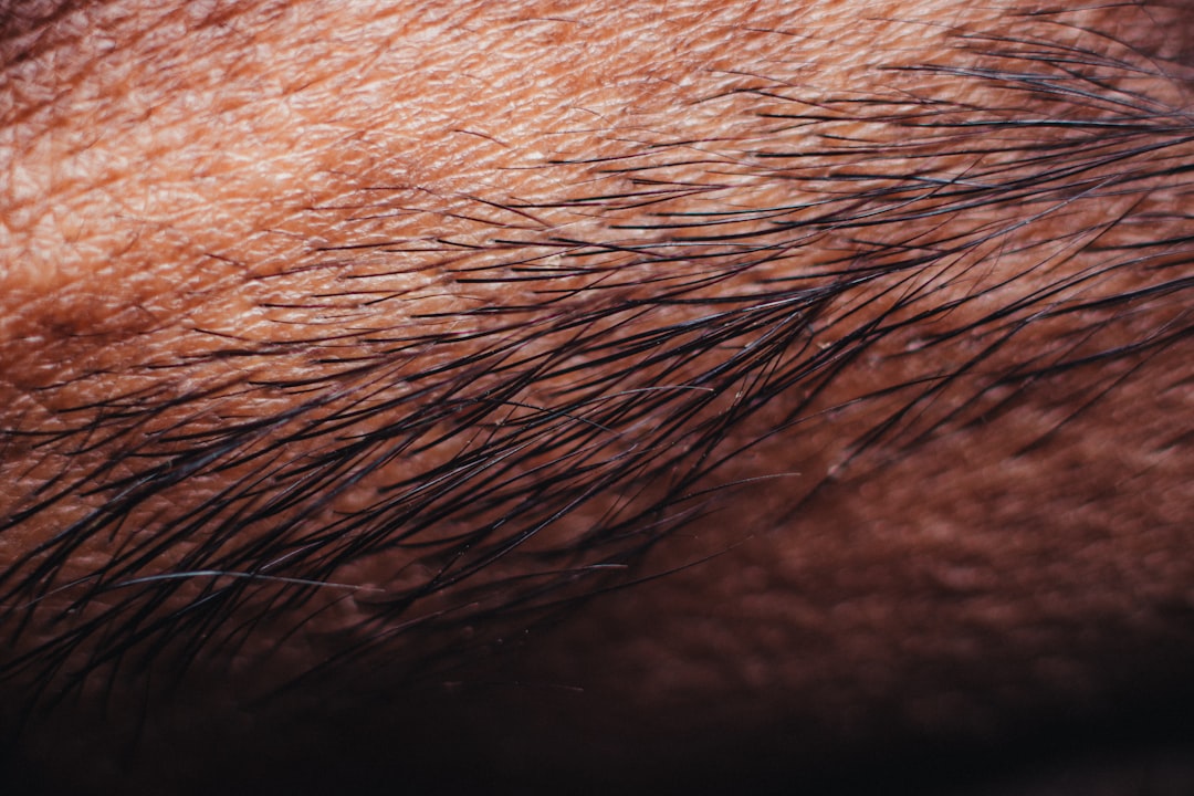 Microblading for hair loss